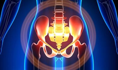 Las causas de las venas varicosas de la pelvis